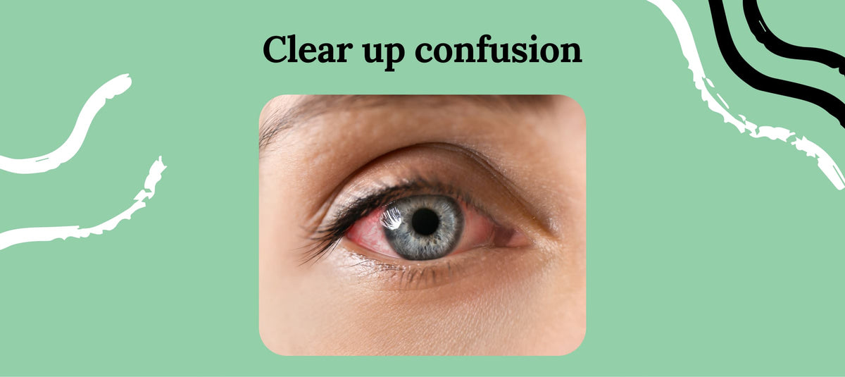 Allergy Eyes vs Pink Eye: Know the Difference