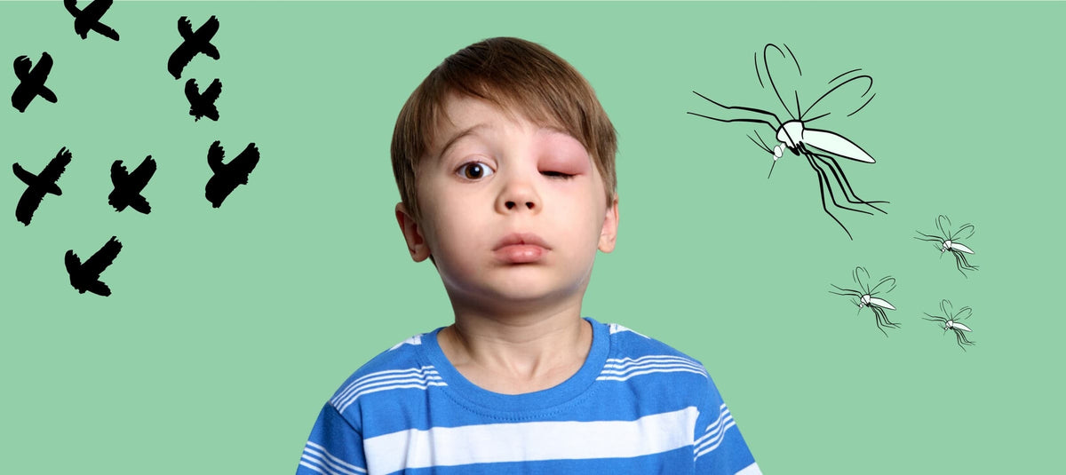What to Do If You Get a Mosquito Bite on Eyelid 