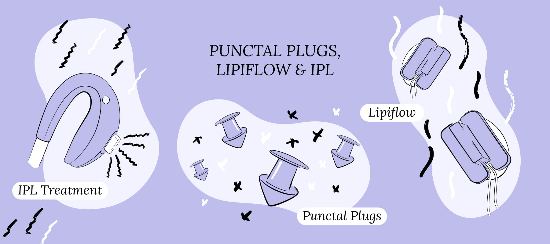 Punctal Plugs, LipiFlow, & IPL