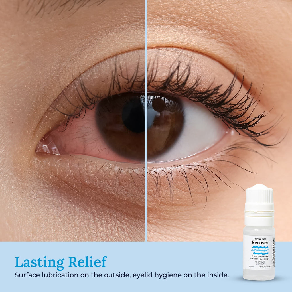 Recover Preservative Free Artificial Tears Eye Photo